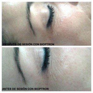 BIOP ANTES Y DESPUES